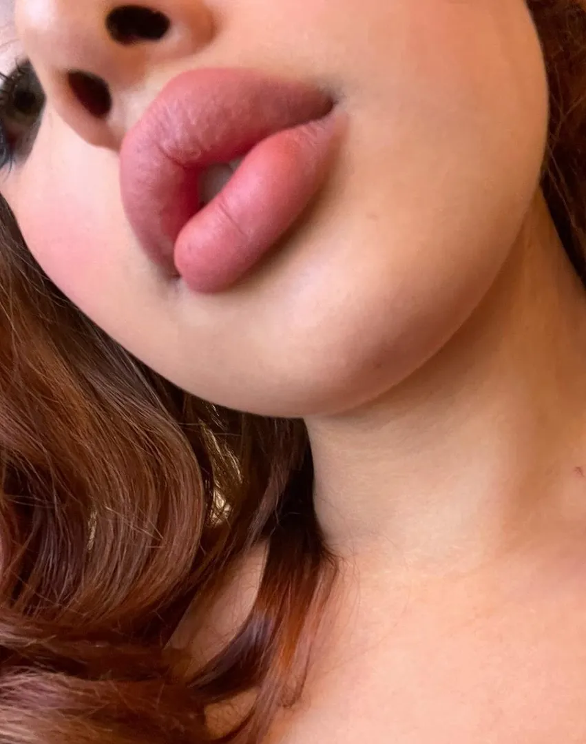 Image attachment from a user